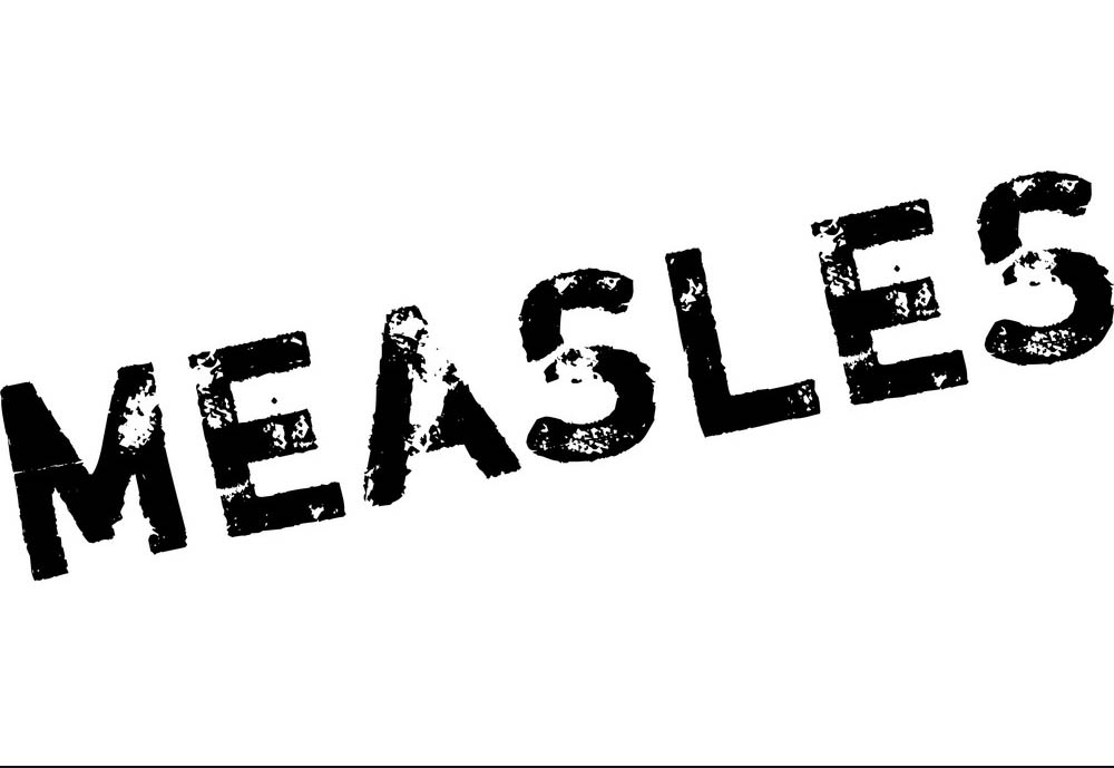 Health Bureau records 2nd imported case of measles