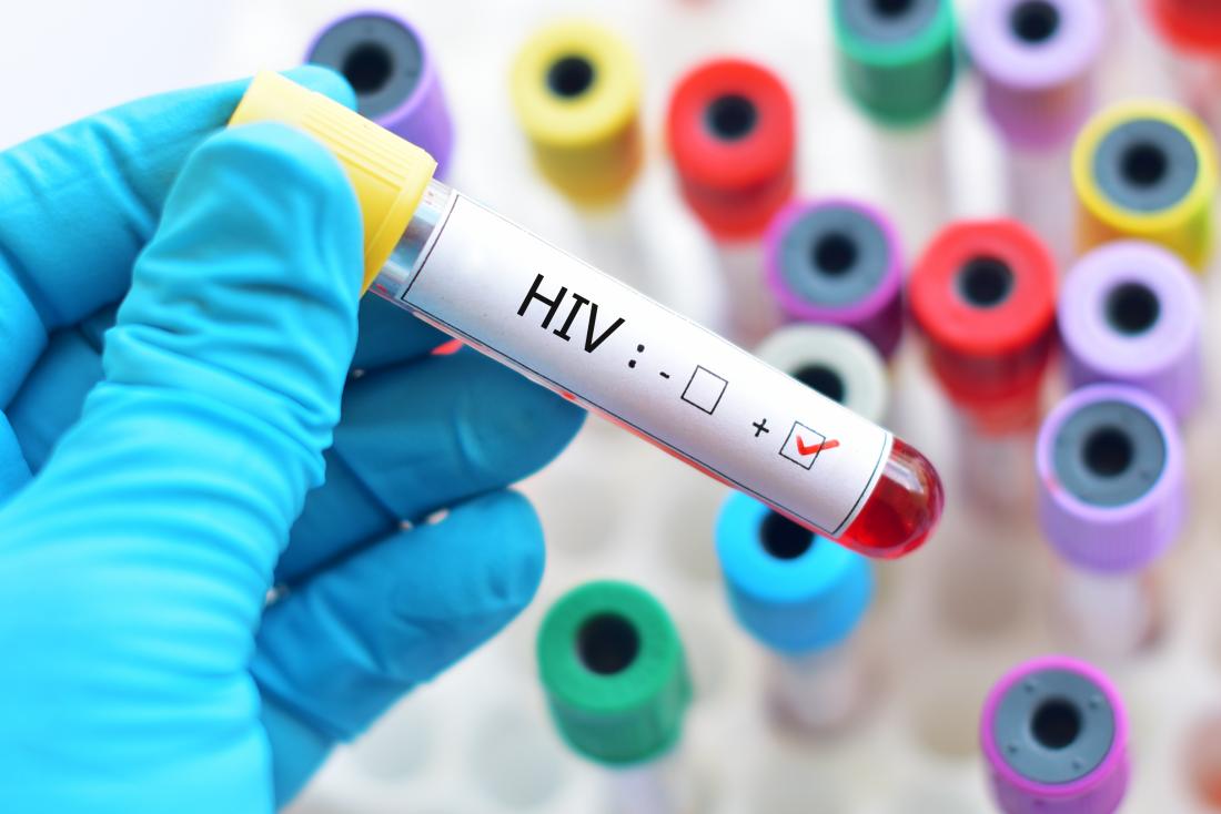 11 HIV cases diagnosed between January and May