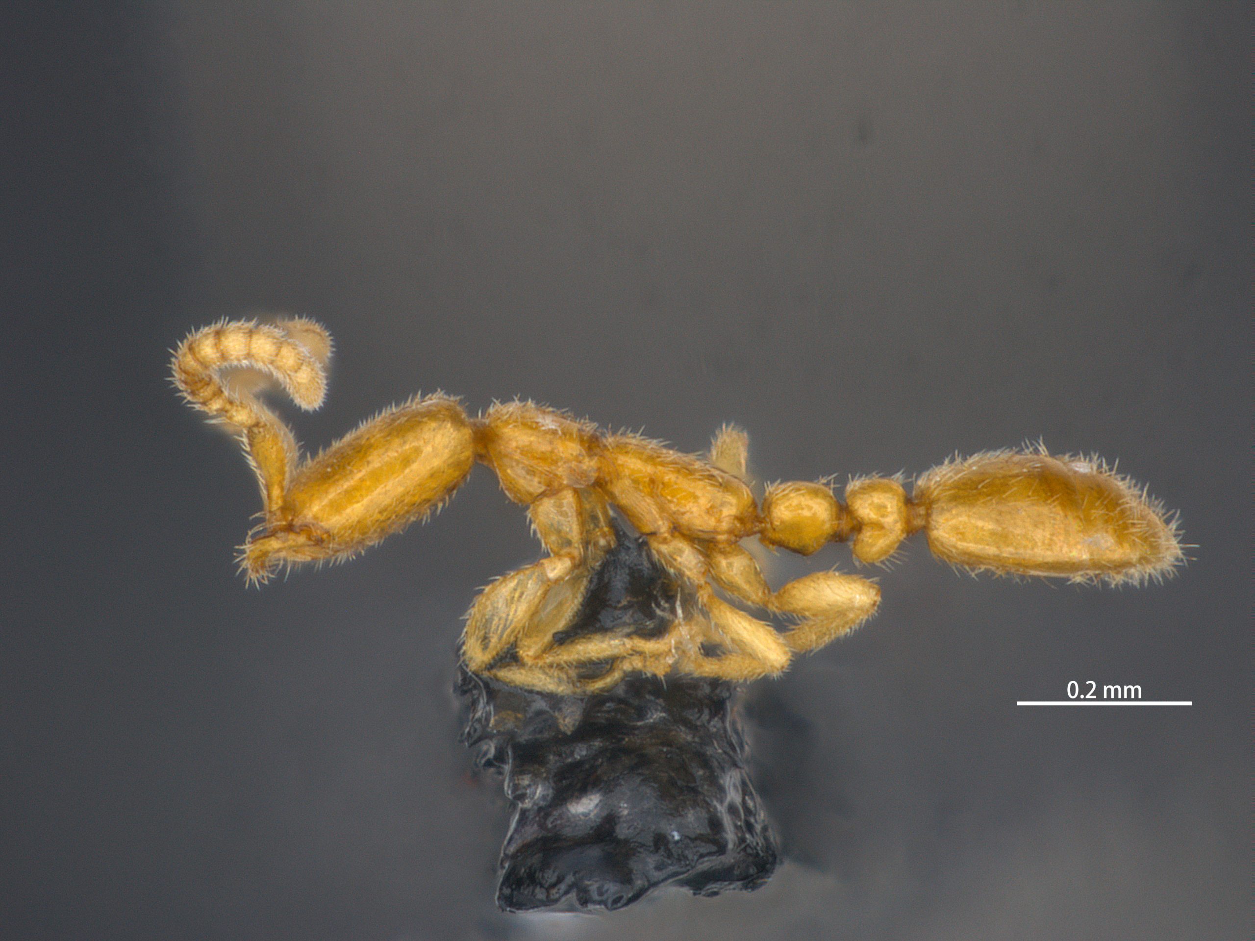 MICROSCOPIC IMAGE OF LEPTANILLA MACAUENIS