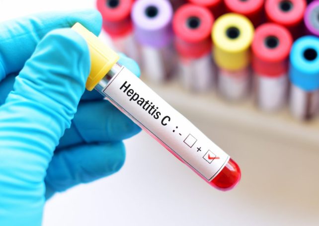Health Bureau offers free hepatitis C tests to at-risk groups