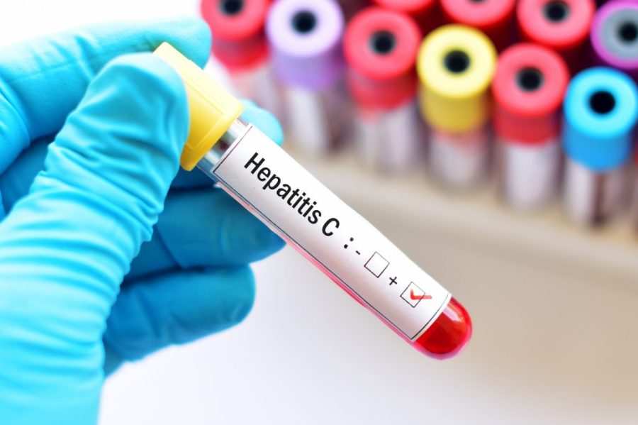 Health Bureau offers free hepatitis C tests to at-risk groups