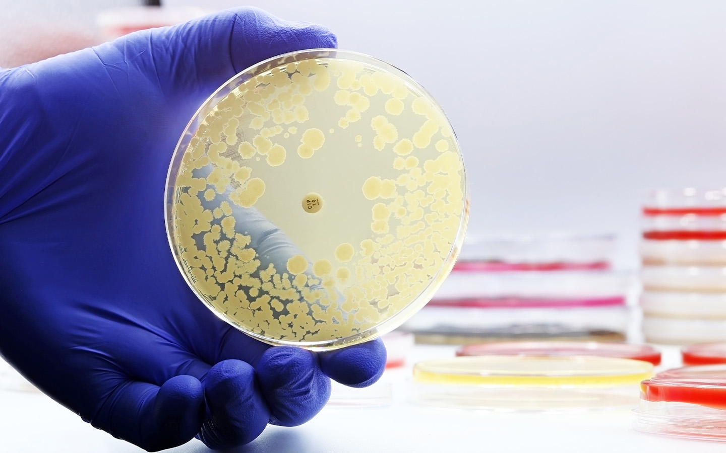 World faces growing threat from antibiotic-resistant infections, study finds