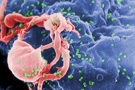 Australian research team announces possible ‘new pathway’ to curing HIV