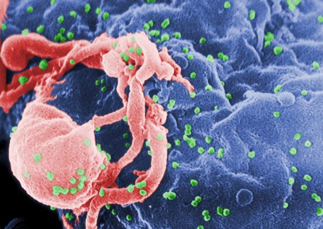 Australian research team announces possible ‘new pathway’ to curing HIV