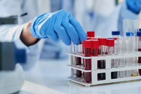 Macao recorded its first two local chikungunya transmissions last week