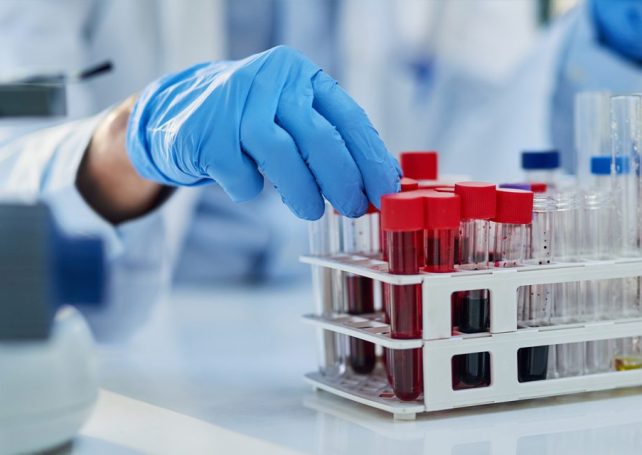 Macao recorded its first two local chikungunya transmissions last week 