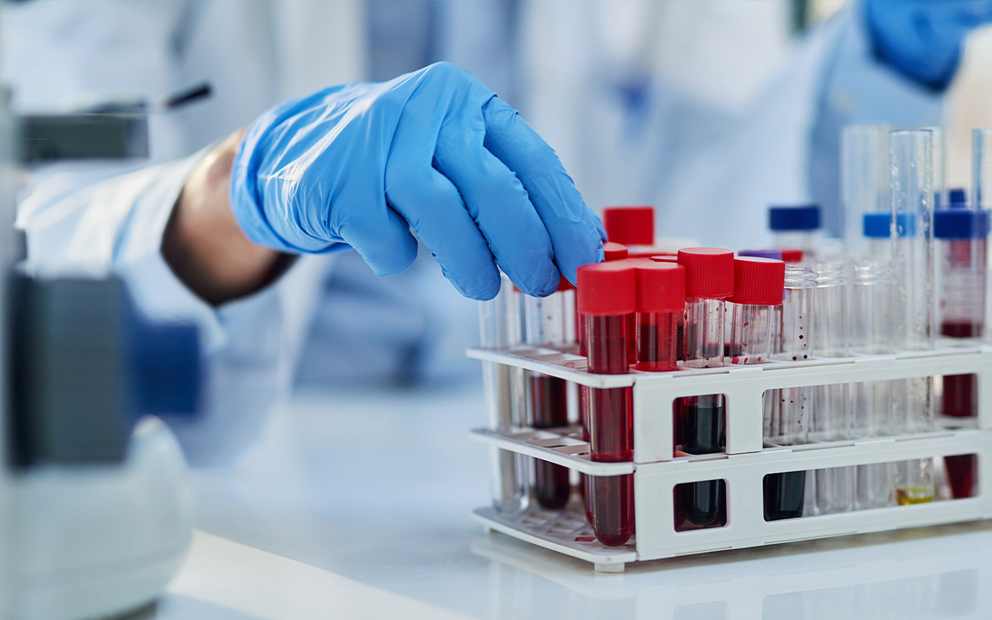 Macao recorded its first two local chikungunya transmissions last week 