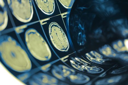 VIVIT - Chinese scientists develop ‘X-ray vision’ for brain tissue