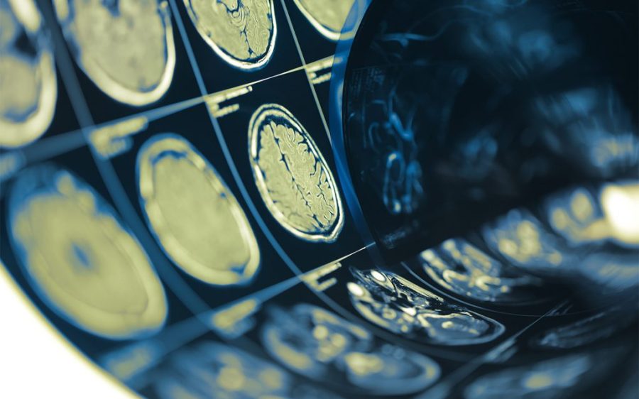 Chinese scientists develop ‘X-ray vision’ for brain tissue