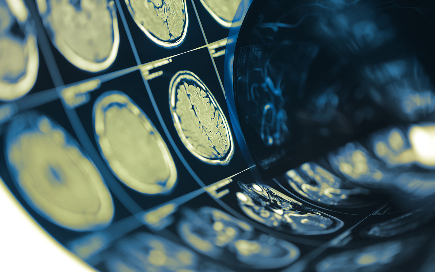 Chinese scientists develop ‘X-ray vision’ for brain tissue