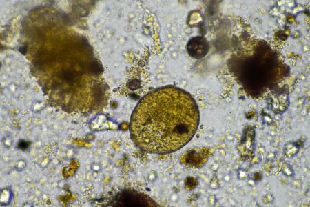 There is a growing public health risk from amoebae tied to climate change