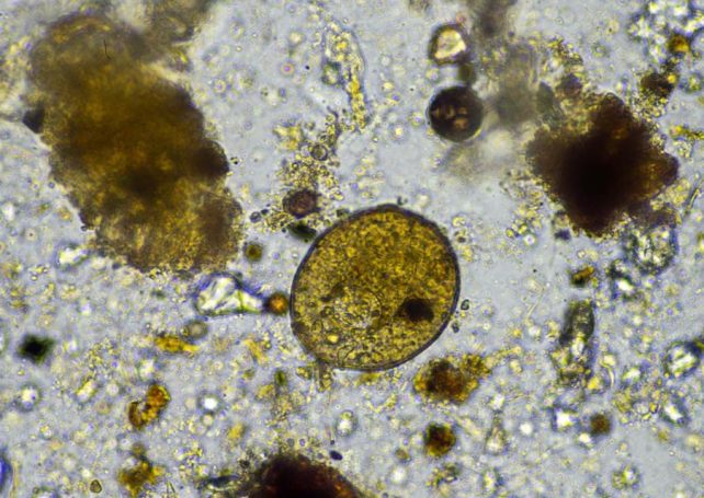 There is a growing public health risk from amoebae tied to climate change