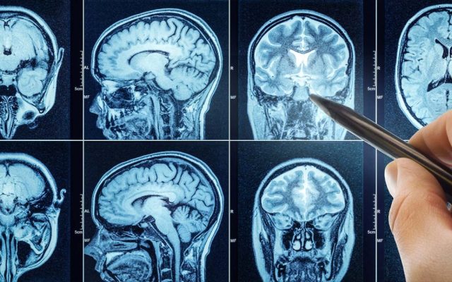 Small ‘nudges’ of electricity to the brain make you more altruistic, a study finds