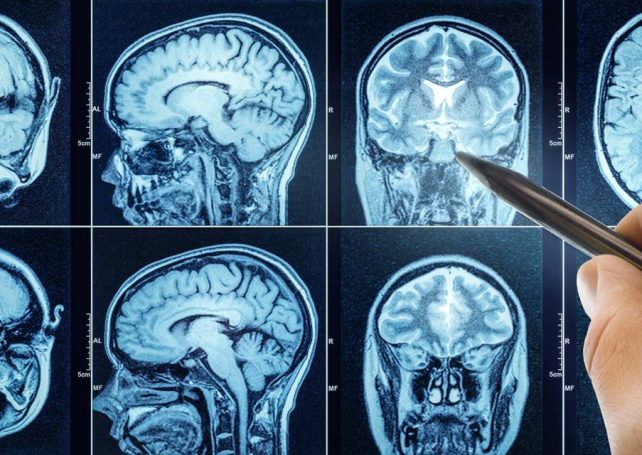 Small ‘nudges’ of electricity to the brain make you more altruistic, a study finds