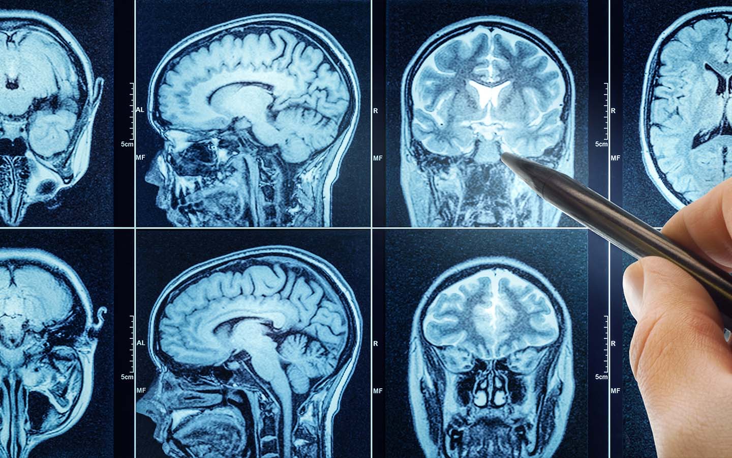 Small ‘nudges’ of electricity to the brain make you more altruistic, a study finds