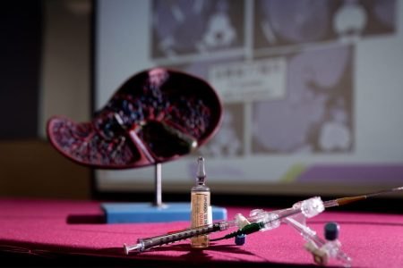 Hong Kong researchers' liver cancer therapy extends survival by 17 months Hong Kong researchers' liver cancer therapy extends survival by 17 months