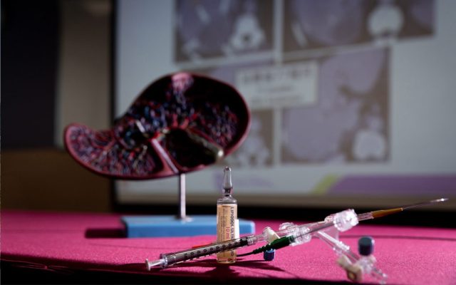 Hong Kong researchers’ liver cancer therapy extends survival by 17 months