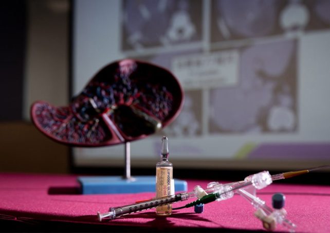 Hong Kong researchers’ liver cancer therapy extends survival by 17 months