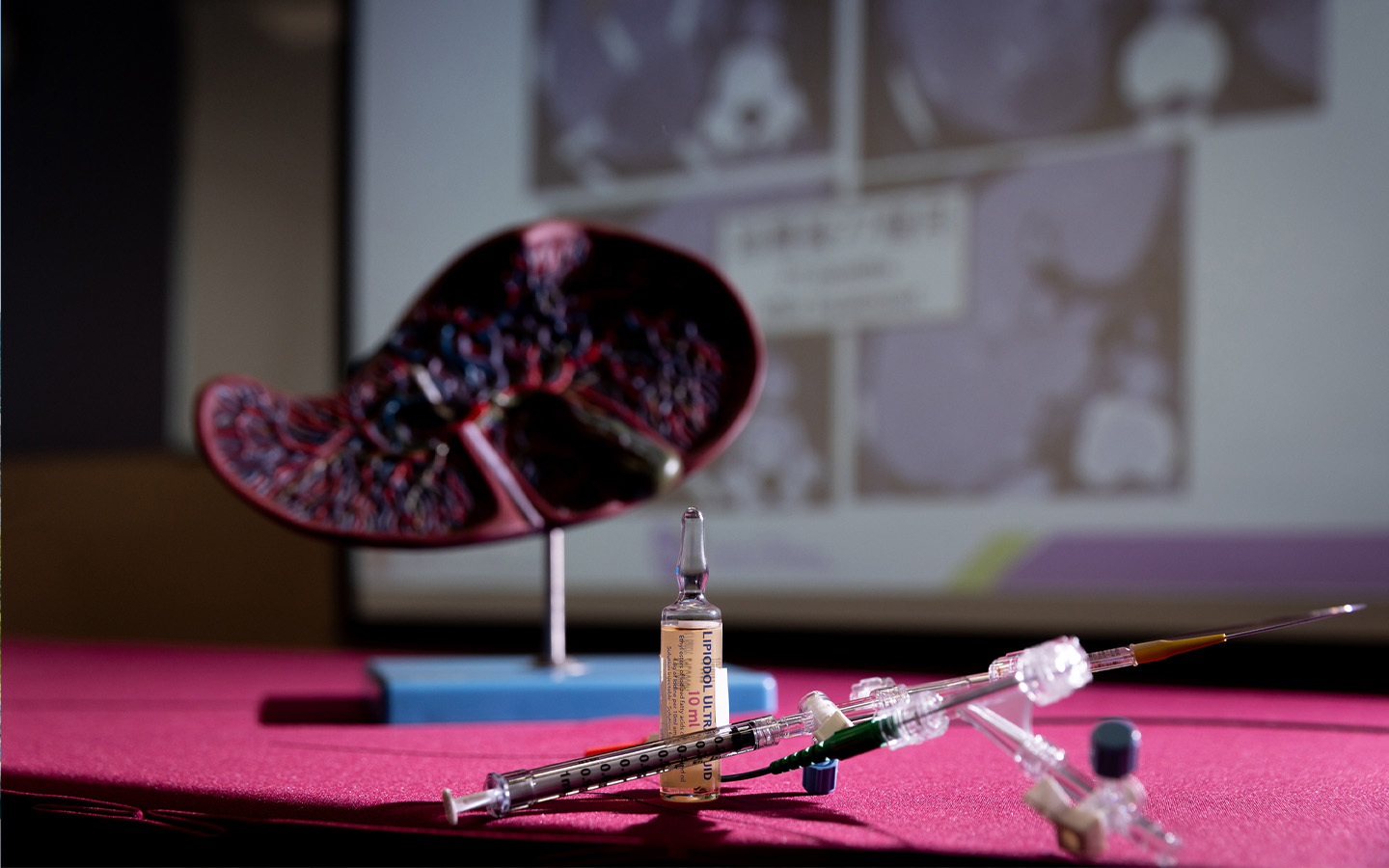 Hong Kong researchers’ liver cancer therapy extends survival by 17 months